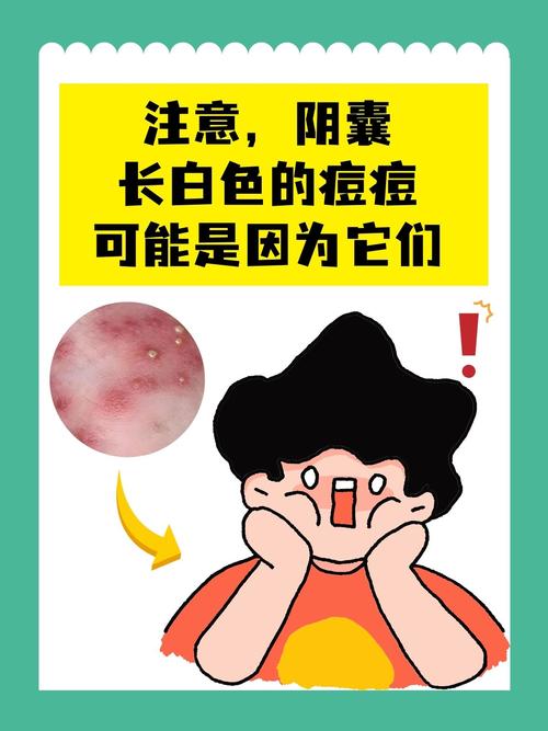 注意,阴囊长白色的痘痘可能是因为它们 阴囊是男性外阴部下垂的囊状物