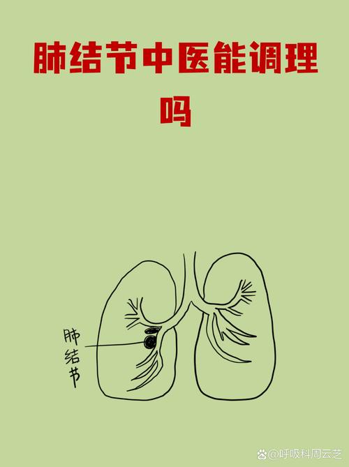 肺结节在体检报告中越来越常见,很多人发现后第