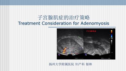 子宫腺肌症的治疗策略2017-01-21